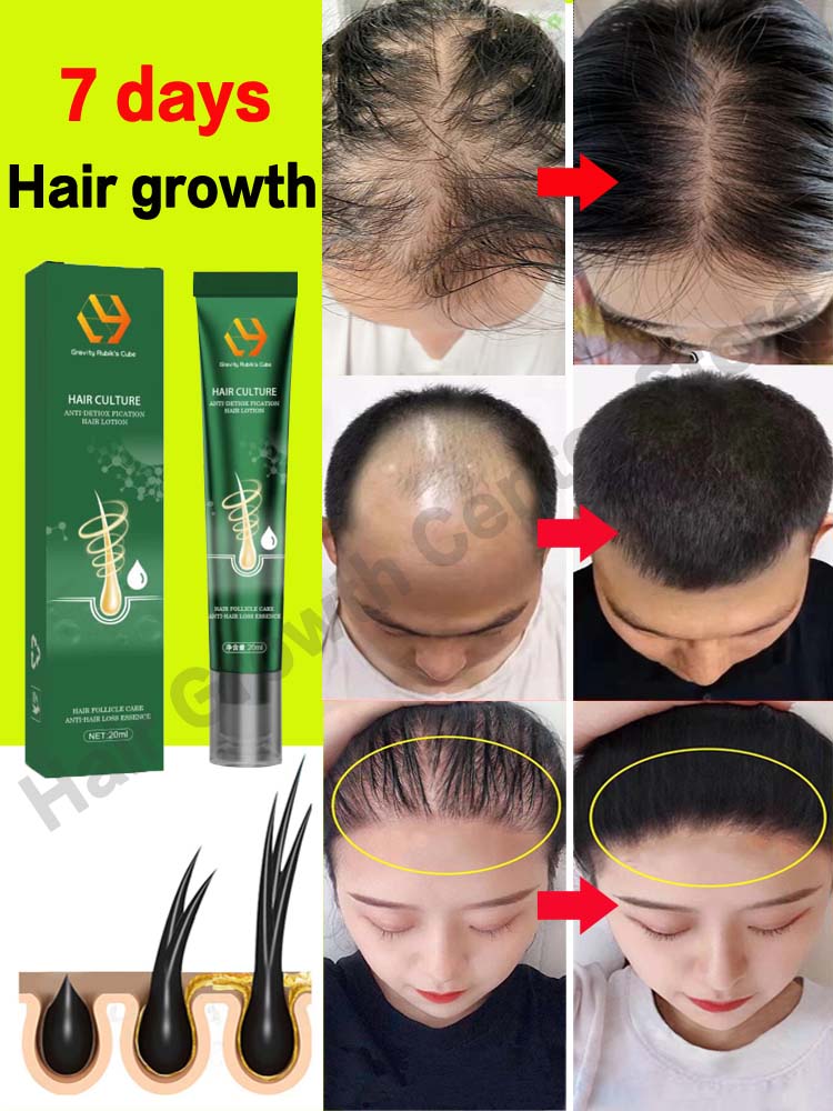 Postpartum Fast Hair Growth Oil