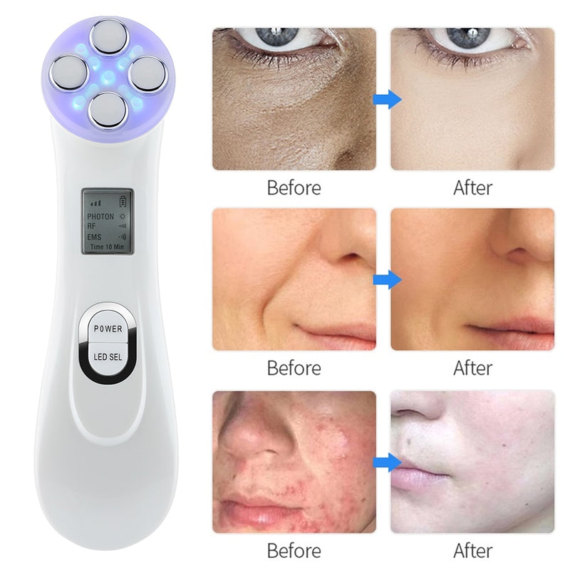 Skin Rejuvenation Face Lift Facial Massager